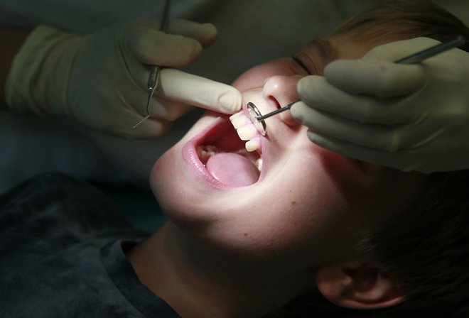 Da vse več otrok in mladostnikov potrebuje ortodontski aparat, je kriva tako evolucija kot razvade sodobnega sveta. FOTO: Leon Vidic