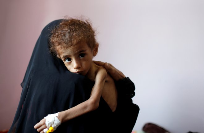 V Jemnu kot posledica vojaškega posredovanja Savdske Arabije na tisoče otrok umira zaradi lakote. Foto Reuters