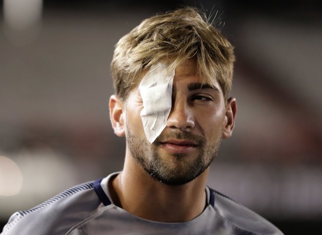 Nogometaš Gonzalo Lamardo ima poškodovano oko, toda vodstvo tekmovanja je od Boce zahtevalo, da vseeno igra. FOTO: AFP