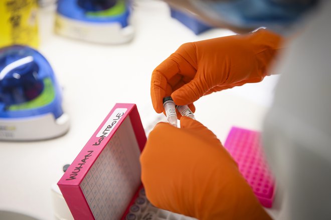 Test brisa nosno-žrelnega predela ostaja zanesljivejši in dražji pokazatelj prisotnosti novega koronavirusa kot test krvi na protitelesa. FOTO: Jože Suhadolnik/Delo