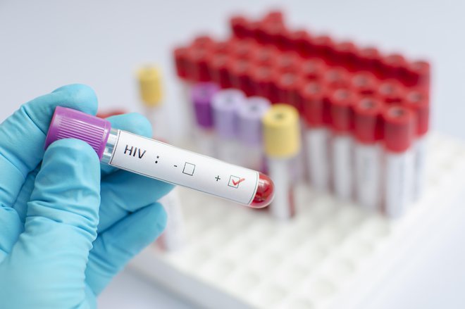 Osebe, ki živijo s hiv, še vedno doživljajo diskriminacijo. FOTO: Getty Images/istockphoto