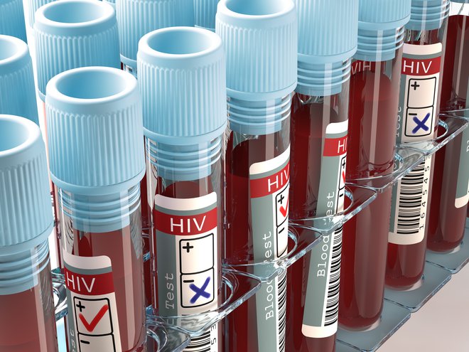 Virus hiv FOTO: Shutterstock