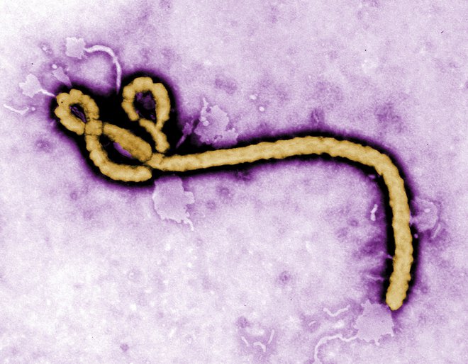 Virus ebole. FOTO AP
