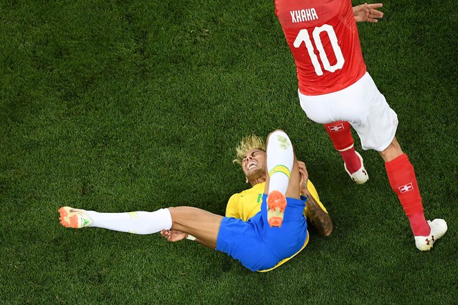 Tiskovni predstavnik brazilske reprezentance je pojasnil, da je poškodba posledica udarca, ki ga je prejel Neymar na prvi tekmi SP proti Švici. FOTO: AFP