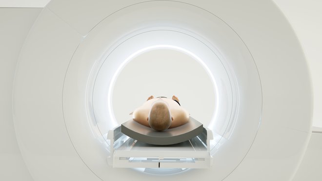 Radioterapija je tehnološko najkompleksnejša veja medicine, njen razvoj pa neločljivo povezan z razvojem sodobne fizike. Foto Shutterstock