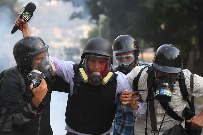V včerajšnjih spopadih je bil ranjen novinar venezuelskega medija VPITV Gregory Jaimes. FOTO: Federico Parra/AFP