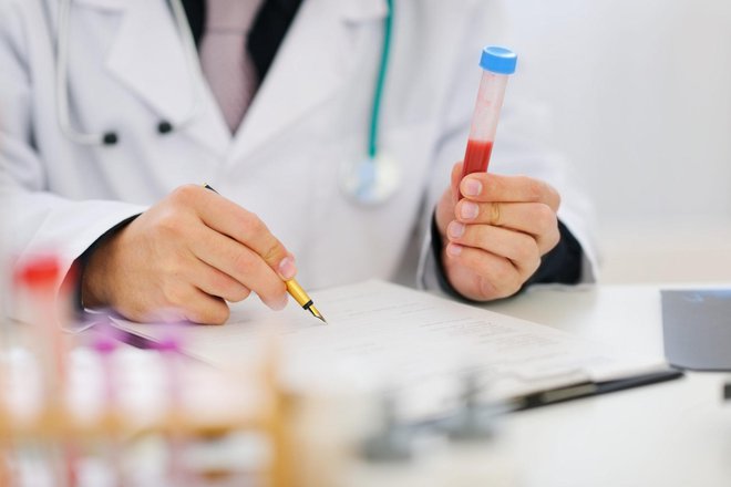 Closeup on hands of medical doctor holding blood sample and making notes