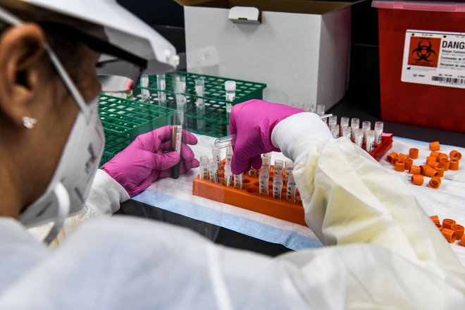 Do zdaj sta prve zelo spodbudne izsledke o cepivih predstavila Moderna in Biontech s Pfizerjem. FOTO: Chandan Khanna/AFP