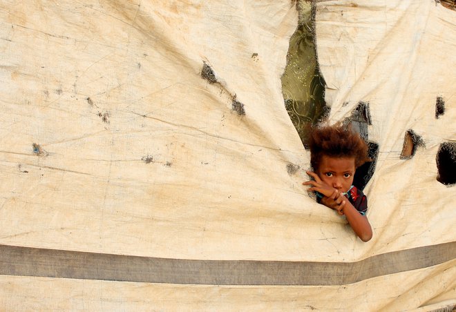 Več kot dva milijona jemenskih otrok, največjih žrtev vojne, je po podatkih Unicefa akutno podhranjenih. FOTO: Essa Ahmed/AFP