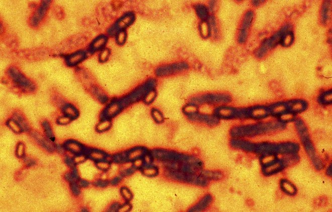 Na zdravila odporne bakterije so velik zdravstveni problem. FOTO: Reuters