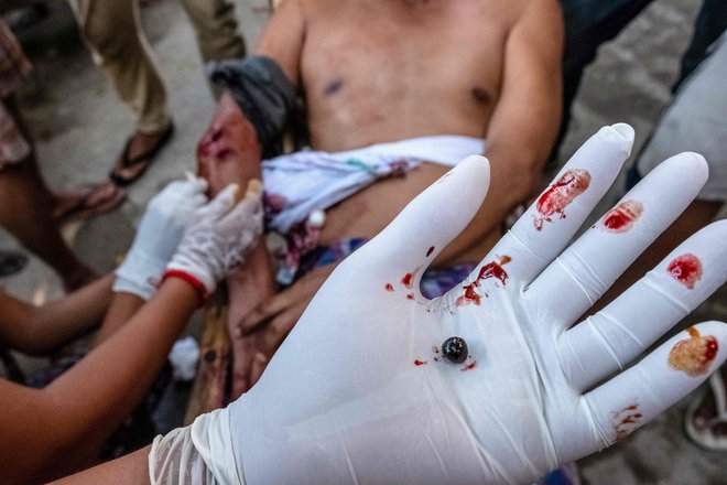 V Jangonu medicinski delavec v roki drži gumijasto kroglo, ki jo je odstranil iz telesa enega od burmanskih protestnikov, na katerega je streljala vojska, ko je želela uničiti barikade, ki so jih protestniki postavili proti vojaškemu puču. FOTO: Stringer/Afp