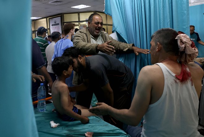 V bolnišnicah se gnetejo ranjeni civilisti. FOTO: Mohammed Abed/AFP