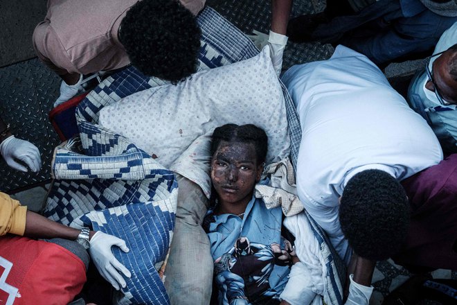 V vojaškem zračnem napadu na tržnico v mestu Togoga v etiopijski regiji Tigray je umrlo najmanj 43 ljudi, večinoma civilistov. Eno od preživelih peljejo v najbližjo bolnico. FOTO: Yasuyoshi Chiba/Afp