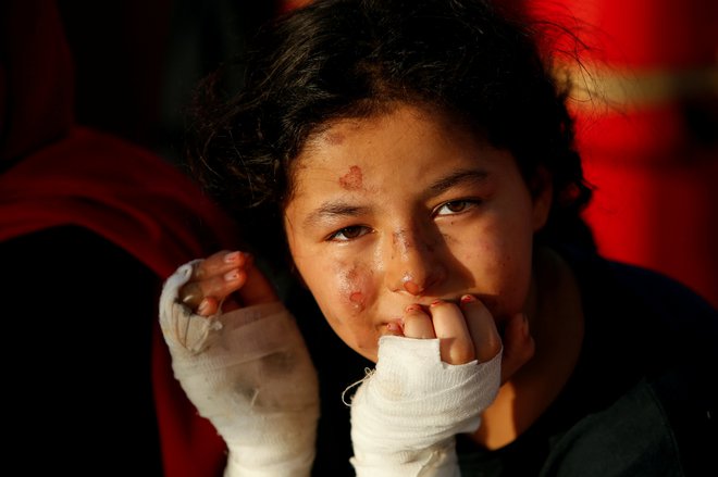 Libijska deklica, ki je v požaru na čolnu polnem migrantov utrpela opekline, sedi na nemški nevladni reševalni ladji Sea-Watch 3, ob obali italijanskega otoka Lampedusa v zahodnem Sredozemskem morju. FOTO: Darrin Zammit Lupi/Reuters<br />
&nbsp;