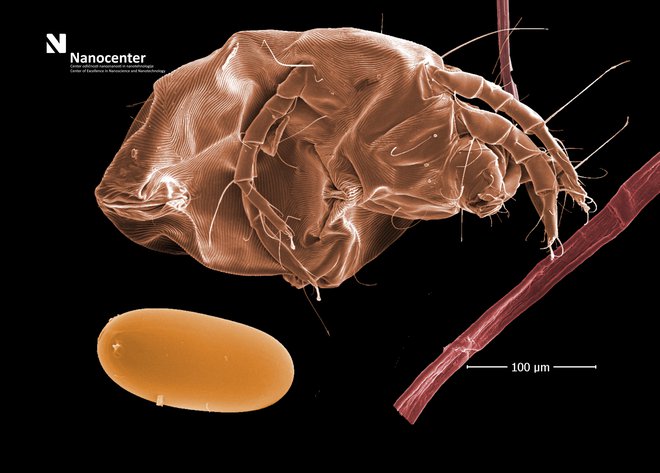 SEM-slika hišne pršice z njenim jajcem ob vlaknu posteljne vzmetnice, kjer je bila ujeta. FOTO: Bojan Ambrožič/Nanocenter