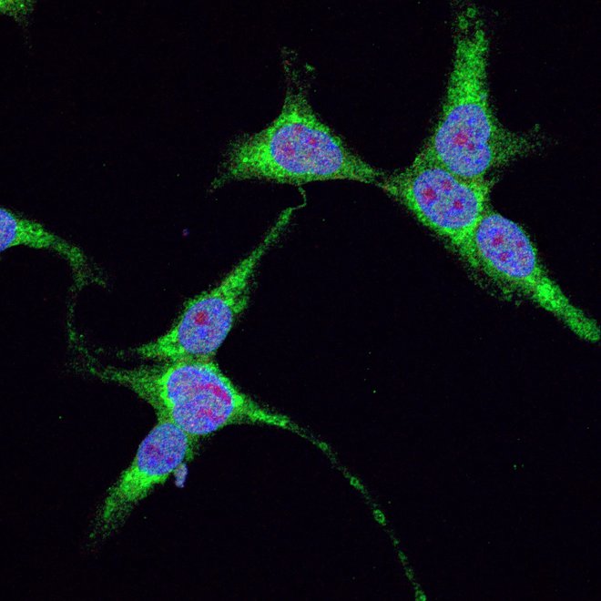 Diferencirane človeške nevroblastoma celice SH-SY5Y, ki izražajo bolezenske dipeptidne ponovitve gena C9orf72. Zeleno so obarvane dipeptidne ponovitve. Modro in rdeče so obarvana jedra celic. Avtor: Janja Božič&nbsp;