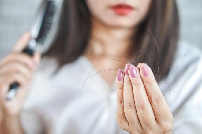 Pri Medicine.net, kjer pišejo o zdravju, je zdravnica Stephanie S. Gardner, dermatologinja z dvajsetimi leti izkušenj, zapisala, katera so naravna zdravila, ki bi morda lahko preprečila izpadanje las. FOTO: Shutterstock
