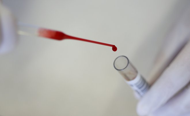 Hematološki bolnik, posebno tisti, ki zboli zaradi rakavih bolezni krvi, je eden najtežjih bolnikov v medicini. FOTO:&nbsp;Michaela Rehle/Reuters
