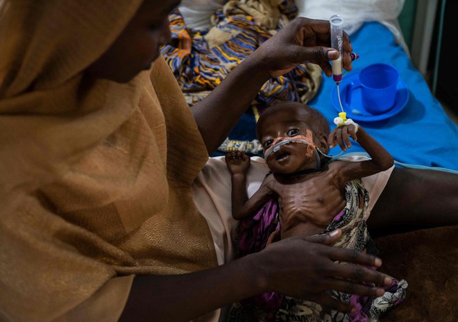 Mariam Ali hrani svojega podhranjenega sina Alija na oddelku za kritično bolne v bolnišnici v Čadu. Povečanje števila primerov podhranjenosti je posledica več dejavnikov. Covid-19 je povzročil dvig cen, kmetijska proizvodnja v zadnjem letu je bila slabša kot v zadnjih petih letih, zdaj pa se zaradi vojne v Ukrajini hitro zvišujejo cene osnovnih živil. Enota ima zmogljivosti za 60 bolnikov, vendar jih sprejema 100, saj število primerov še naprej narašča. Normalno je največ primerov podhranjenosti julija in avgusta, zato se bojijo, da bo enota do takrat popolnoma preobremenjena, saj so zmogljivosti že presežene, pravi vodja operativne podpore iz nevladne organizacije ALIMA, ki jo financira EU. Foto Andrew Caballero-reynolds Afp
