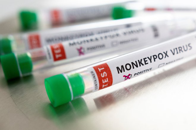 V Sloveniji so potrdili prvi primer okužbe z opičjimi kozami.&nbsp;FOTO: Dado Ruvic/Reuters
