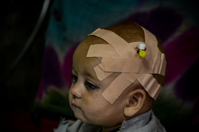 Afganistanski otrok, ki je bil poškodovan v potresu v pokrajini Paktika se zdravi v bolnišnici v mestu Sharan. Potres z magnitudo 5,9, v katerem je umrlo najmanj 1 000 ljudi, je najbolj prizadel težko dostopni vzhod, kjer ljudje že tako živijo težko življenje v primežu humanitarne krize, ki se je po avgustovskem talibanskem prevzemu oblasti še poslabšala. Foto: Ahmad Sahel Arman/Afp
