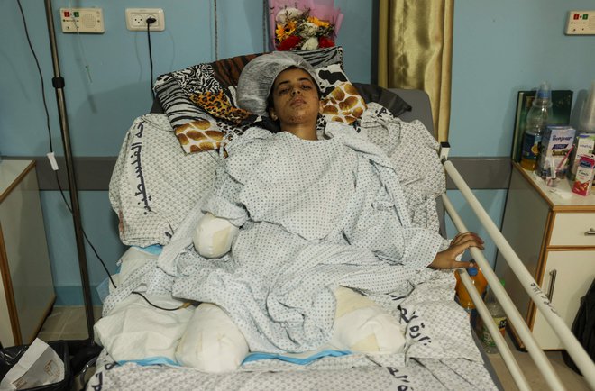 11-letna palestinska deklica Rahaf Salman, ki je v zadnjem spopadu med Izraelom in palestinskimi borci izgubila okončine, je na zdravljenju v bolnišnici v begunskem taborišču Džabalija na severu Gaze. Foto: Mahmud Hams/Afp
