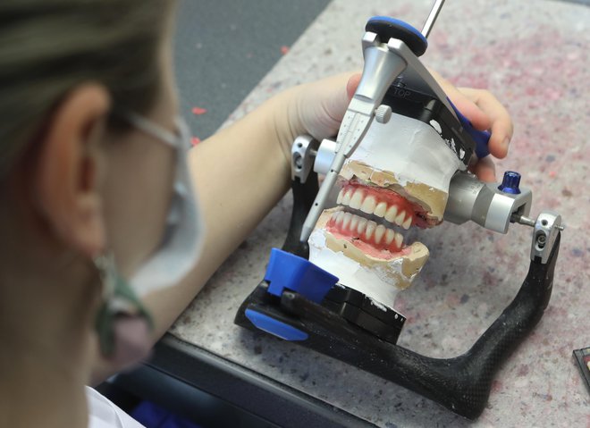 Ker ne bo več doplačil pacientov iz žepa, bo endodontsko zdravljenje (strojno), s katerim rešijo mnogo zob, težje dostopno, čakalne dobe v javnem zobozdravstvu pa se bodo podaljšale, opozarjajo zobozdravniki.

FOTO: Dejan Javornik/DELO