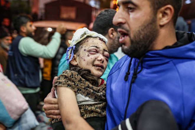 Ranjene Palestince evakuirajo iz indonezijske bolnišnice na severu Gaze. Izrael medtem nadaljuje napade v Gazi. V nočnem zračnem napadu na begunsko taborišče Nuseirat v osrednji Gazi je bilo po poročanju Al Džazire ubitih najmanj 20 ljudi, med njimi tudi ženske in otroci. Več ljudi je ranjenih, nekateri so v kritičnem stanju. Foto: Afp