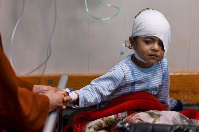 Ranjen palestinski malček v bolnišnici Naser. FOTO: Mohammed Abed/AFP