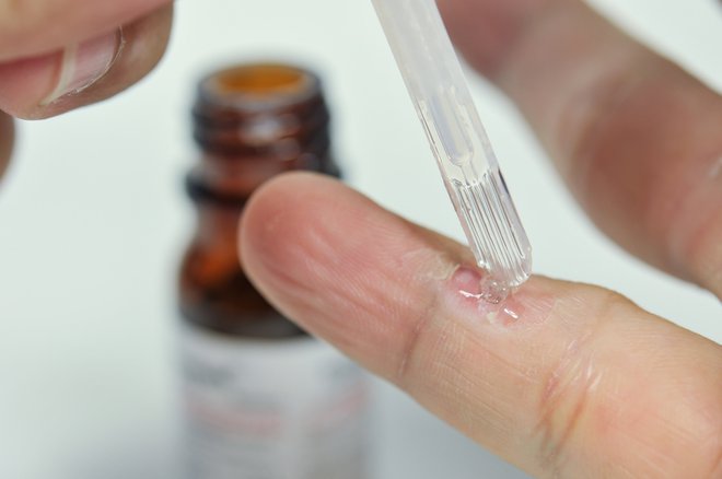 HPV so »krivi« za najbolj razširjeno in hkrati najbolj spregledano spolno prenosljivo bolezen med mladimi in starejšimi.FOTO: Shutterstock