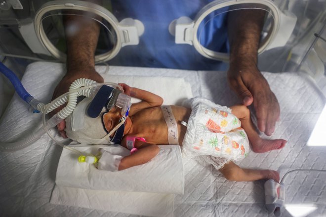 V bolnišnici v Rafi na jugu Gaze zdravnik skrbi za Sabreen al-Ruh al-Sheikh, palestinsko dojenčico, ki se je rodila predčasno s carskim rezom nekaj minut pred smrtjo njene matere, ki je bila hudo ranjena v izraelskem zračnem napadu. Foto: Afp