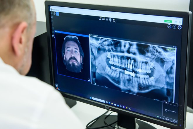 Ortoimplant Dental Spa se posveča zdravljenju tudi najhujših primerov brezzobosti. FOTO: Darko Tomas/CROPIX