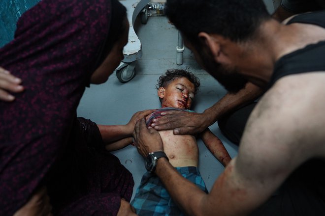 Mati drži za ramo palestinskega malčka Khaleda, medtem ko mu moški poskuša rešiti življenje v bolnišnici mučencev Al Aksa v osrednjem delu Gaze, potem ko je bil hudo ranjen v včerajšnjem izraelskem bombardiranju hiše v mestu Nuseirat. Foto: Bashar Taleb/Afp