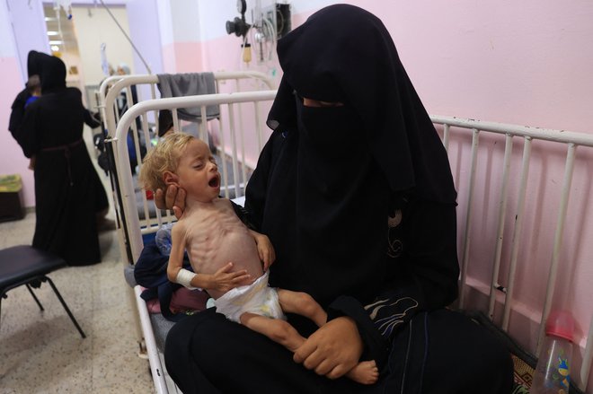 ZN so razglasili lakoto po vsej Gazi. FOTO: Eyad Baba/AFP