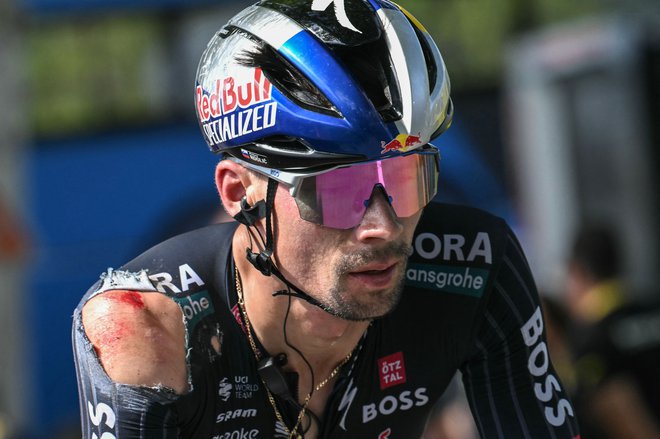 (FILES) Red Bull - BORA - hansgrohe team's Slovenian rider Primoz Roglic, with visible injuries sustained in a crash in the final kilometers of the stage, cycles past the finish line of the 12th stage of the 111th edition of the Tour de France cycling race, 203,6 km between Aurillac and Villeneuve-sur-Lot, southwestern France, on July 11, 2024. Leading contender Primoz Roglic has withdrawn from the Tour de France before the start of stage 13, his team Red Bull Bora Hansgrohe said on July 12, 2024. (Photo by Marco BERTORELLO/AFP) Foto Marco Bertorello Afp