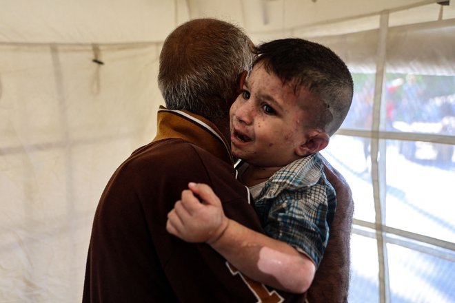 Palestinski deček čaka na zdravljenje opeklin v bolnišnici al Mamadani, ki jih je dobil po napadu izraelske vojske na šolo, v katero so se zatekli razseljeni Palestinci. FOTO: Omar Al-qattaa/Afp