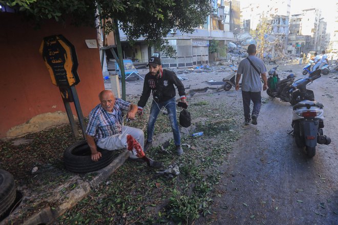 Prebivalec Bejruta, ranjen v napadu na eno od južnih predmestij FOTO: AFP