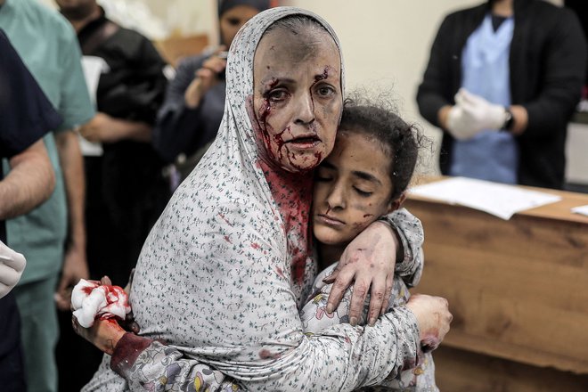 Ranjena Palestinka objema deklico, obe sta bili ranjeni v izraelskem napadu. FOTO: Belal Khaled/Afp