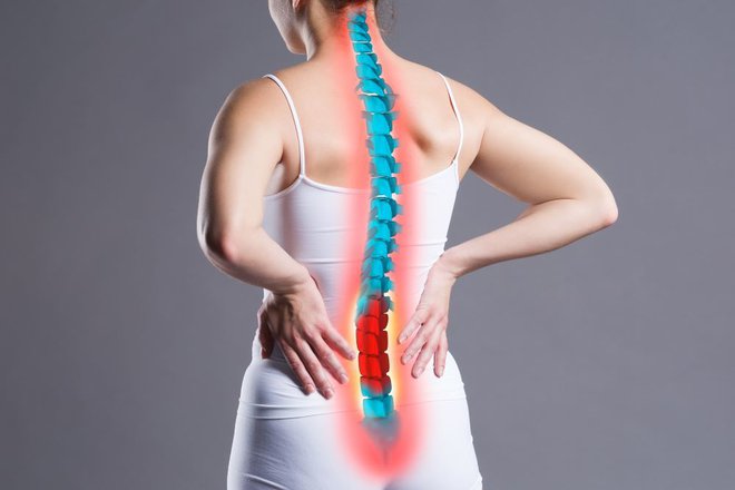 Spinalna stenoza je stanje za katero je značilno zoženje hrbteničnega kanala, kar lahko povzroči pritisk na hrbtenjačo in živce. FOTO: Medicofit