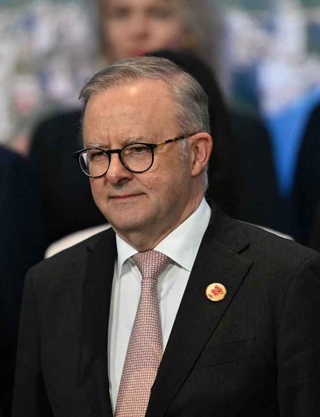 Anthony Albanese FOTO: Mauro Pimentel/AFP