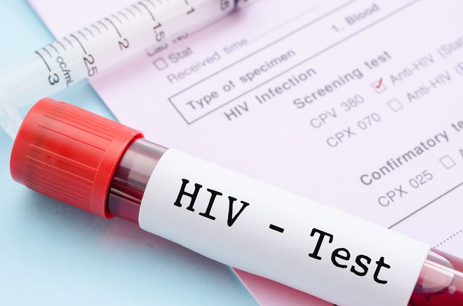 V skupnem programu nevladnikov, stroke in države Odziv na hiv imajo vse več uporabnikov. FOTO: Shutterstock