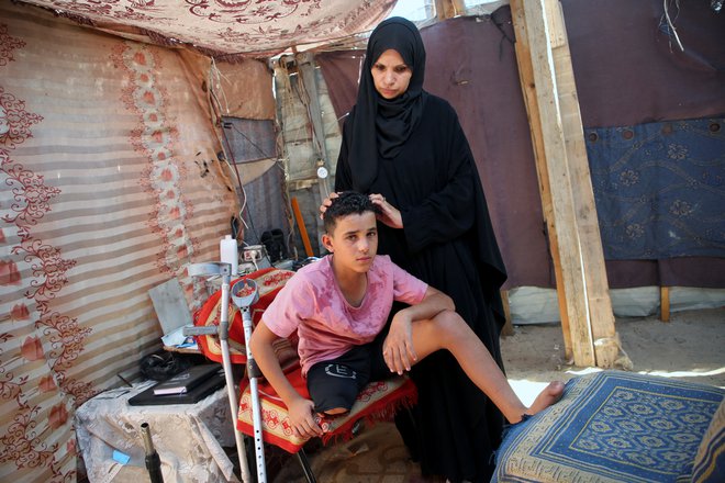 Palestnski deček Waseem Mohammed, ki je izgubil nogo med izraelskim napadom. FOTO: Hatem Khaled/Reuters