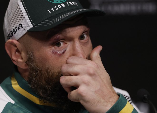 Ali se je Tyson Fury tokrat boksarsko res upokojil ali nas je spet potegnil za nos? FOTO: Andrew Couldridge/Reuters